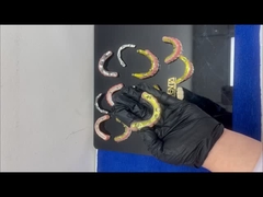 สะพานไฮบริด Ti-Bar Zirconia