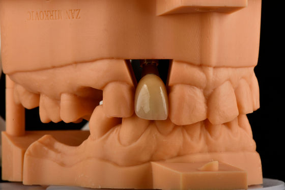 ซื้อ Hex ภายใน 3.0mm ความลึก 1.5mm Pitch ติดต่อกัน การผลิตออนไลน์