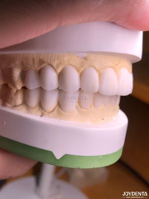 ซื้อ เครื่องคาดคะแนนดิจิตอลที่กําหนดเอง สําหรับการจําลองรูปร่างฟันธรรมชาติ การผลิตออนไลน์