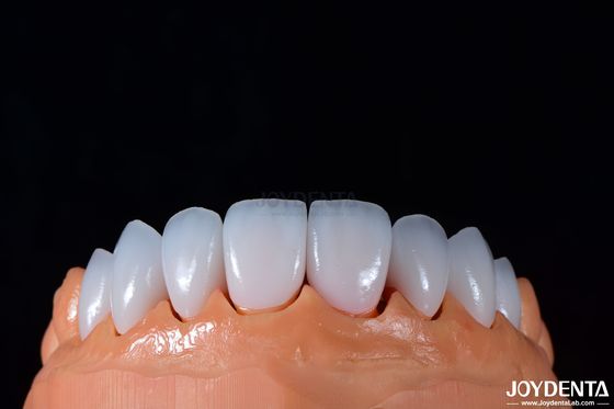 ซื้อ 0.3-0.5 มม ความหนา Emax Porcelain Veneer สําหรับการฟันเสริมความสดใสสูง การผลิตออนไลน์