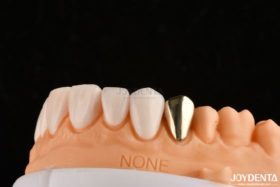 ซื้อ Ultra Thin IPS Emax Press Veneers โคสเมติกฟันฟันฟันสําหรับการฟื้นฟูหน้าหลัง การผลิตออนไลน์