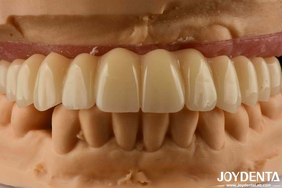ซื้อ โซลูชั่นฟัน Ti-Base Zirconia Hybrid Bridge ความเข้ากันได้สูง การผลิตออนไลน์