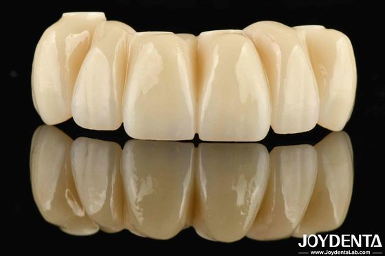 ซื้อ การฟื้นฟูฟัน Ti-Base Zirconia Hybrid Bridge สภาพธรรมชาติ การผลิตออนไลน์