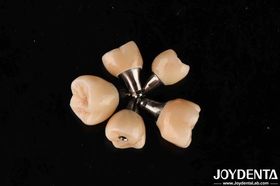 ซื้อ สกรู รีเทชั่น ทิตาเนียม Abutments การเชื่อมต่อ Hex ภายในสําหรับการปลูกฟัน การผลิตออนไลน์