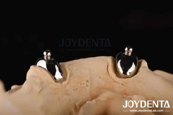 ซื้อ Joydental ห้องปฏิบัติการฟัน Ball การผลิตออนไลน์