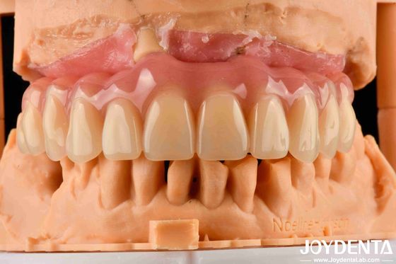 ซื้อ สะดวกสบาย การสวมฟันปลอม Acrylic จบด้วยเทคโนโลยีการจัดวางฟัน การผลิตออนไลน์
