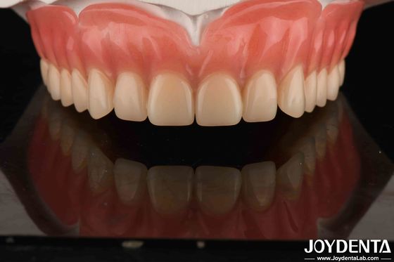 ซื้อ ฟันอะคริลิค ปลายฟัน ผงเบา ผงผงฟัน ปรับฟัน การผลิตออนไลน์