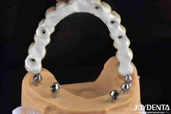 ซื้อ สูตรฟันแรงสูง Ti-Base Hybrid Zirconia Bridge ทนต่อการแตก การผลิตออนไลน์