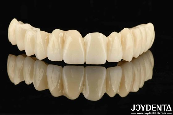 ซื้อ การออกแบบฟัน PMMA หลายชั้นแบบร่วงแบบไร้รอย สําหรับการเปลี่ยนเงาตามธรรมชาติ การผลิตออนไลน์