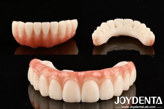ซื้อ PMMA M75 ความโปร่งใสสูง สําหรับการฟื้นฟูฟื้นฟูความสวยงามและทนต่อรอยขีดข่วน การผลิตออนไลน์