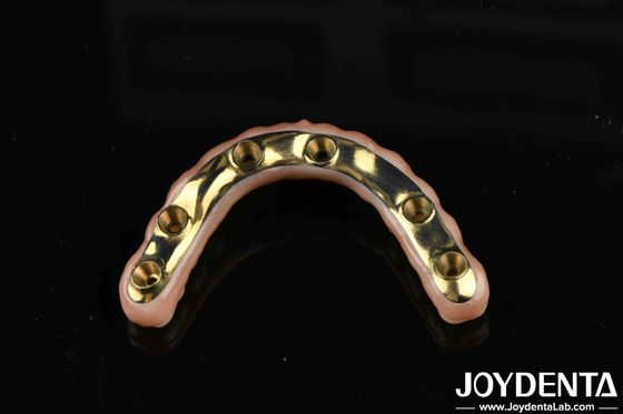 ซื้อ สะพานไฮบริดไซร์คอนเนีย Ti-Bar สําหรับความสบายใจและความทนทานในการฟัน การผลิตออนไลน์