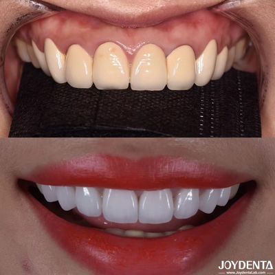 ซื้อ CAD/CAM รองรับ Zirconia ราชกุฎฟัน การผลิตความแม่นยําสําหรับสีสันและขนาดที่เหมาะสม การผลิตออนไลน์