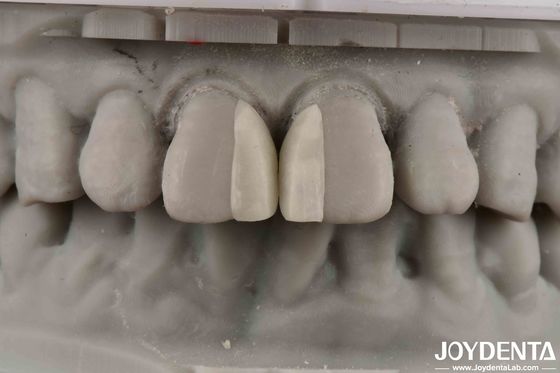 ซื้อ พื้นที่โค้ง กันไฟ ไมโครฟูเนียร์สําหรับตกแต่งภายใน การผลิตออนไลน์