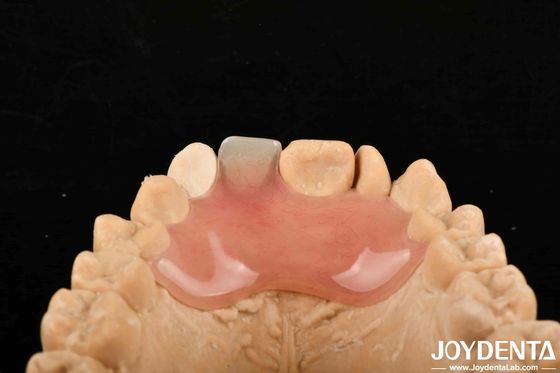 ซื้อ ความลับสูง ความยืดหยุ่นดี ปลายฟันเทียมยืดหยุ่น สําหรับกระบวนการผลิตที่หลากหลาย การผลิตออนไลน์