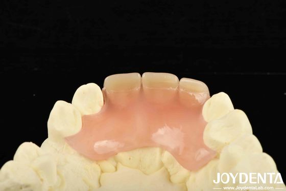 ซื้อ เปลี่ยนแปลงการทําทันตแพทย์ ด้วยผลิตภัณฑ์เบาและหลากหลาย การผลิตออนไลน์