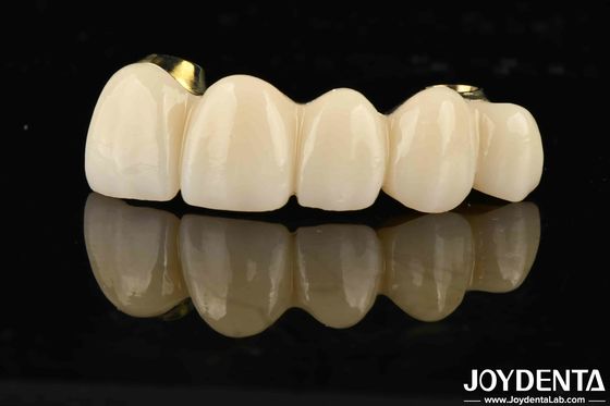 ซื้อ สะพานไฮบริด Ti-Bar Zirconia ความแข็งแรงที่ดีที่สุด สําหรับฟันและยางที่เข้ากันได้ตามธรรมชาติ การผลิตออนไลน์