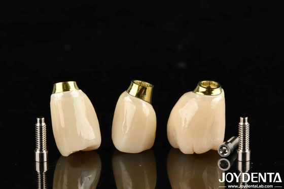 ซื้อ ความทนทานสูง สีขาว ปลายการปรับปรุงมงกุฎและสะพาน การผลิตออนไลน์