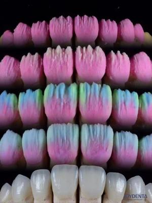 ซื้อ The Joydenta Ceramic Veneer Process การผลิตออนไลน์