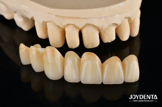 ซื้อ Unveil True Biomimicry: Introducing Our Multi-Layered Zirconia Aesthetic Bridge การผลิตออนไลน์