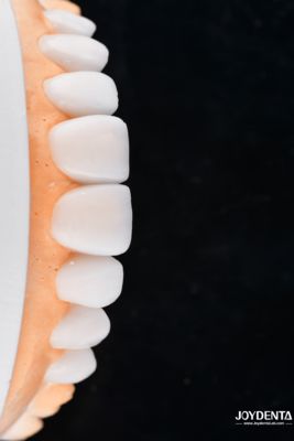 ซื้อ Enhance Case Acceptance & Patient Communication with Our Diagnostic Wax-Up Service การผลิตออนไลน์