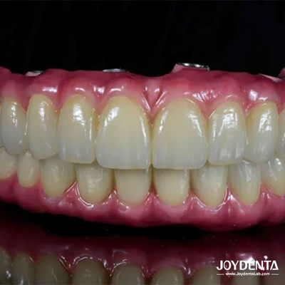 ซื้อ สะพานไฮบริดทิตาเนียมฟันเบา สะพานที่สะดวกสําหรับการฟัน การผลิตออนไลน์