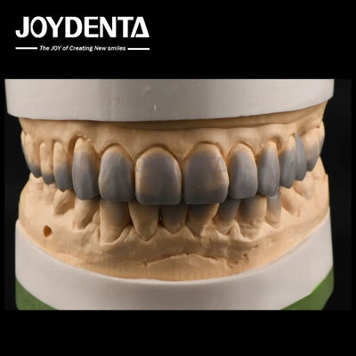 ซื้อ การใช้ชั่วคราว การวินิจฉัย Wax Ups เนื้อเยื่อเรียบ ฟัน Wax Up Custom การผลิตออนไลน์