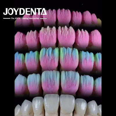 ซื้อ The Joydenta Ceramic Veneer Process การผลิตออนไลน์