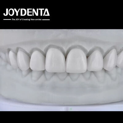 ซื้อ Visualize the Result, Secure the Case: Our Diagnostic Wax-Up Service การผลิตออนไลน์