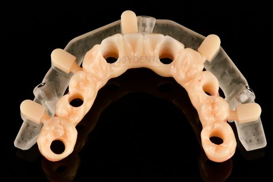 โครงการผ่าตัดที่นําโดยการพิมพ์ 3D ที่มีความแม่นยําตามสั่ง สําหรับการวางเครื่องปลูกที่แม่นยํา
