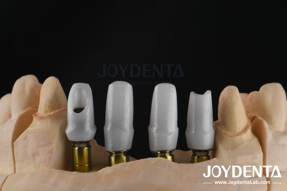 อุปกรณ์จําเพาะปลูกฟัน Zirconia Abutment สําหรับการฟื้นฟูหน่วยเดียวหรือหลายหน่วย