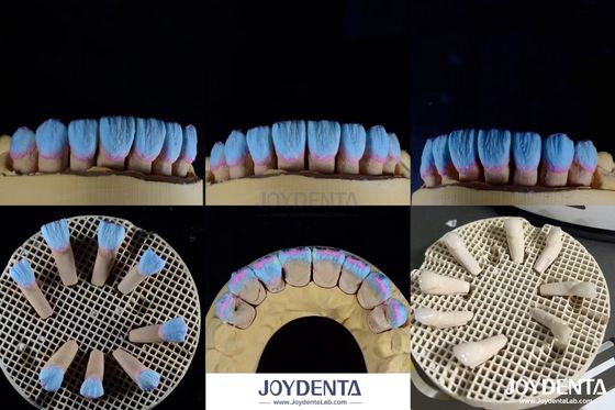 ความเหมาะสมทางชีวภาพสูง Feldspathic Ceramic Veneer Glossy สําหรับการฟื้นฟูฟัน