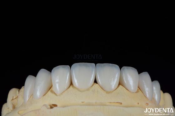 เนื้อผิวกระจ่าง กระจก Feldspathic กระจก Porcelain กระจกที่ดูธรรมชาติ