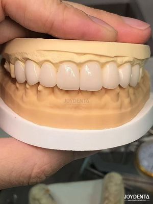 16 สี สี Emax แฟนเนอร์ฟัน A1-A4 ความทนทานต่อคราบสูง สําหรับรอยยิ้มที่สมบูรณ์แบบ