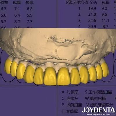 โปรแกรมการออกแบบฟัน Digital Wax Up กับความปลอดภัยข้อมูลที่สอดคล้องกับ HIPAA