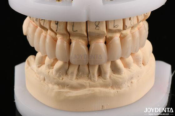 พื้นผิวเคลือบ ความแข็งแรง flexural Zirconia ชั้นสําหรับสะพาน 6.0-6.1 G/cm3 ความหนาแน่น