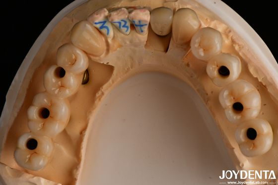 ธาตุ Zirconia แบบเต็มรูปแบบหลายชั้น มีความโปร่งใสสูง 1200 HV