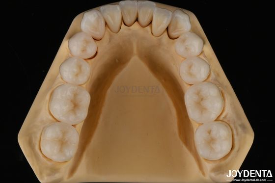 3D Multilayer Dental Full Zirconia ความต้านทานต่อการฉีกฟันธรรมชาติ