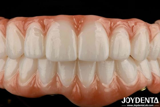 ยาวนาน ทิตาเนียม Bar Zirconia สะพานไฮบริด ดูธรรมชาติ Aesthetics สําหรับการฟื้นฟู