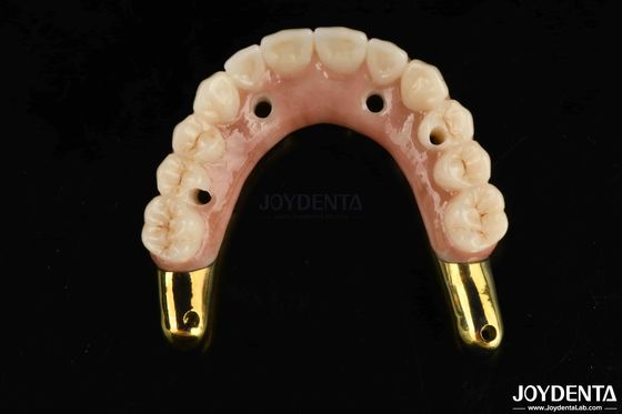 ทนทานการสวม Zirconia สะพานไฮบริดกับ Ti-Bar ฟันธรรมชาติที่เข้ากันได้และยี่ห้อ