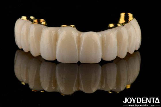 การปรับปรุงสะพานไฮบริดซิรคอนิยม (Zirconia Bridge)