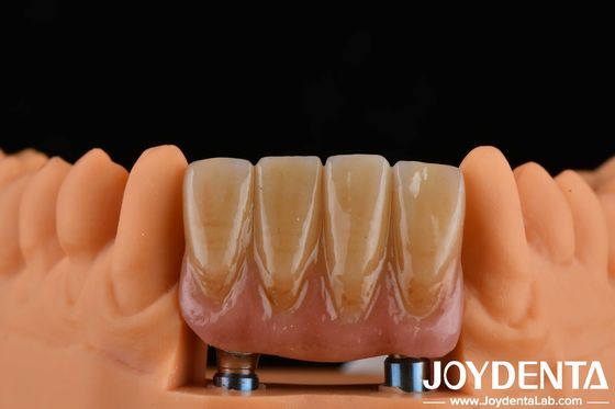 4.5mm ความสูง ปลาย Abutments แบบการเชื่อมต่อ Hex ภายใน