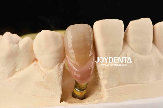 0 ° มุม ปลายฟัน Abutments 1.5 มิลลิเมตร Thread Pitch พื้นที่เคลือบ