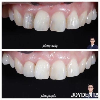 สวยงาม ทรัพยากร ธาตุ Zirconia สีธรรมชาติ ความทนต่อการแตกสูง