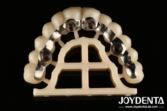 เหรียญเงินปลาย Custom Abutments And Bars ชิ้นสกรูที่เหมาะสม