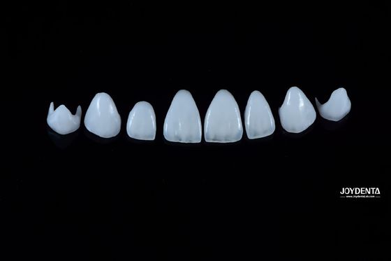 0.3-0.5 มิลลิเมตร หนา โปรเซลีนธรรมชาติ Emax Veneers ความแข็งแรงสูง ยาวนานสําหรับความสวยงาม