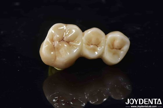 ความเข้ากันทางชีวภาพสูง Zirconia Full Contour Crown เหมาะสมอย่างสมบูรณ์ ความแข็งแรงสูง