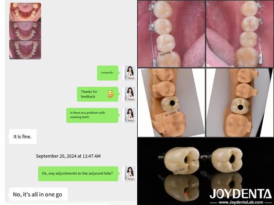 อุปกรณ์ปลูกฟันแบบบานเต็มยาวนาน อุปกรณ์ปลูกฟันภายในกระดูก ความยาว 10mm-16mm