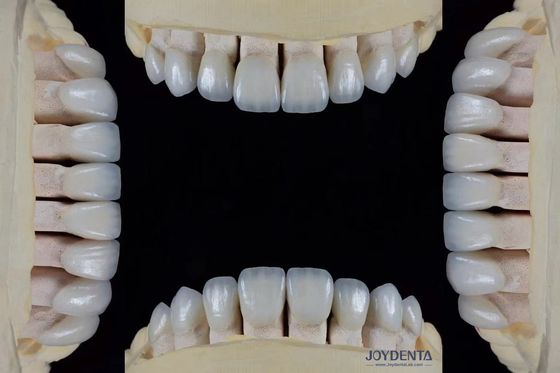 Ultra Thin Feldspathic Veneer ความหนา 0.3-0.5 มิลลิเมตร ความต้านทานคราบสูง