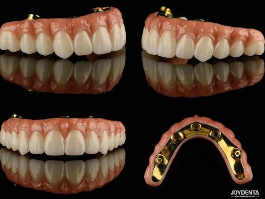 Ti Bar Zirconia Hybrid Implant Bridges ความโปร่งใสสูง สําหรับขั้นแต่งฟัน