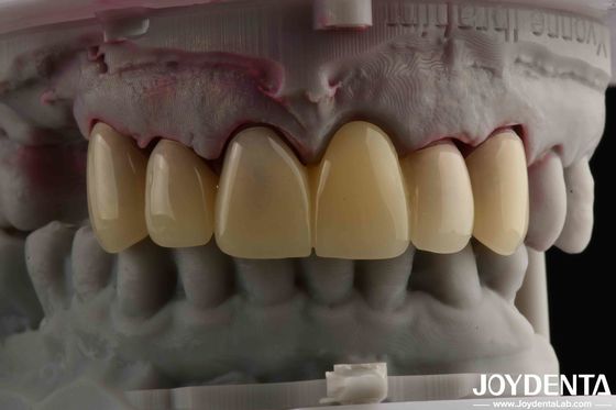 CAD CAM Processing Dental PMMA Material Multilayer Design สําหรับการเปลี่ยนเงาตามธรรมชาติ